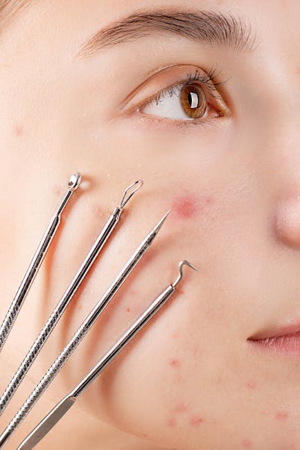 Close-up of a young person's face with clear skin and brown eyes, showing part of their cheek and lips. Several stainless steel dermatology or skincare removal tools with pointed and curved tips are p